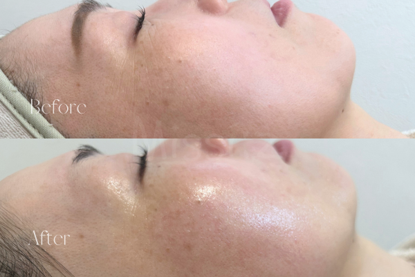 上まつげパーマ＋美肌フェイシャルワックス