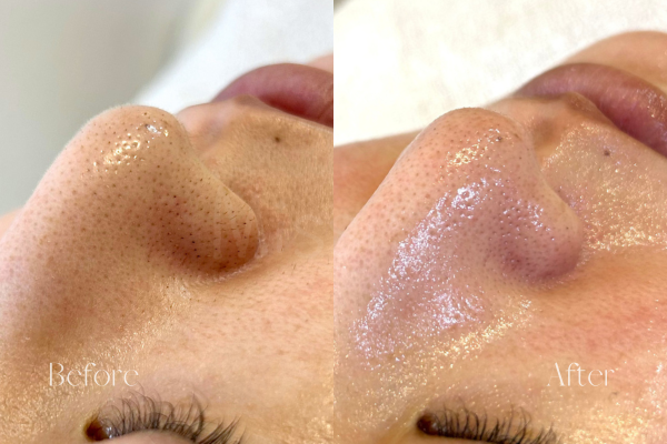 ミッシーズのフェイシャルワックス