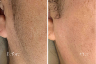 ミッシーズのフェイシャルワックス