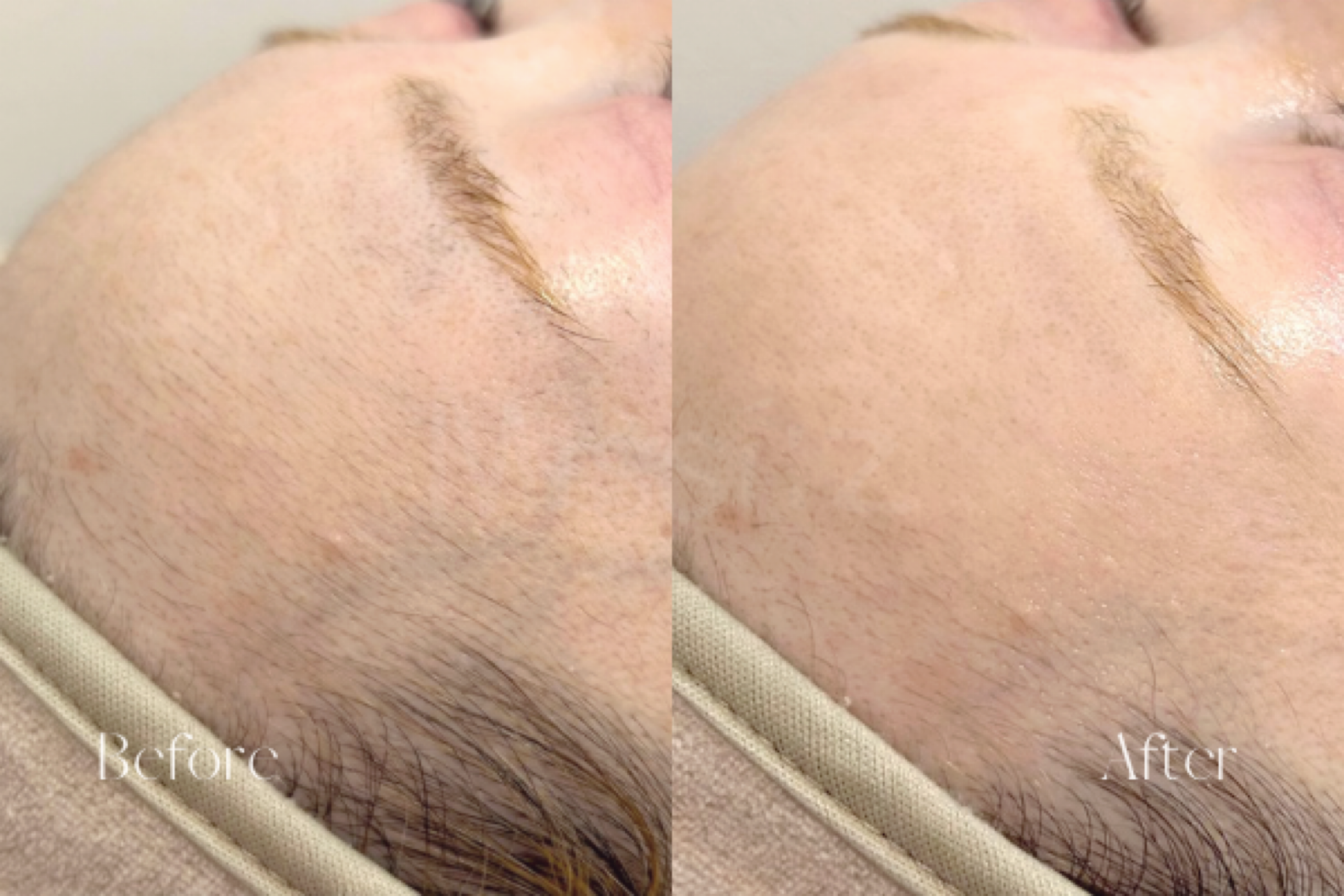 美眉スタイリング＋美肌フェイシャルワックス