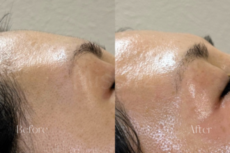 ミッシーズのフェイシャルワックス