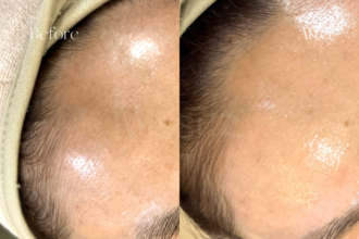 南相馬市でツヤ肌を手に入れるなら。Missíːzの美肌ワックスで毛穴レスな自分へ