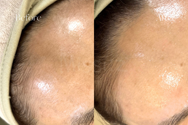 ミッシーズのフェイシャルワックス